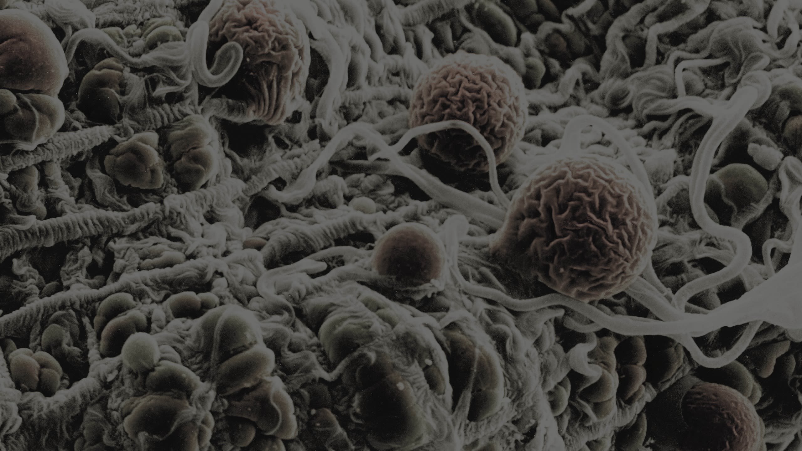 Credit: Malaria parasites. Hilary Hurd. Attribution-NonCommercial 4.0 International (CC BY-NC 4.0)
